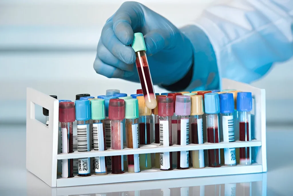 square diagnostics, square pharma, buy diagnostics equipment in delhi ncr, buy diagnostic kits in delhi ncr, buy diagnostic plasticware in delhi ncr, best diagnostic labware dealer in delhi, best diagnostic plasticware dealer in delhi, Diagnostic Goods in delhi, buy laboratory chemicals in delhi, thermo fisher scientific, qualigens, tarsons, polylab, borosil, buy pharma goods in delhi, best pharma supplier in delhi, but laboratory glassware in delhi ncr, buy vaccutainer in delhi ncr, buy bio medical waste goods in delhi, buy syringe in delhi ncr, buy dispovan syringe in delhi ncr, buy dispovan products in ghaziabad, biggest lab equipment supplier in delhi ncr, hmd products supplier, dispovan products supplier in ghaziabad